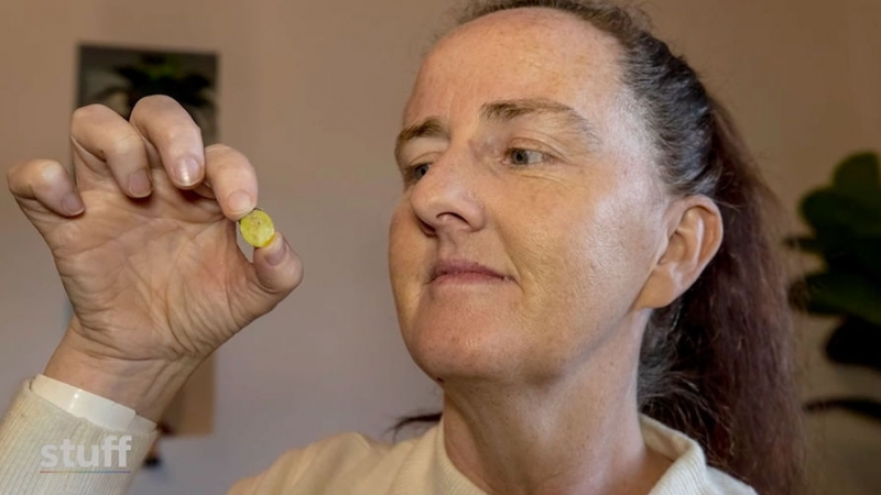 «Насмешила всю больницу»: женщина почти всю жизнь проходила с игрушкой в ноздре